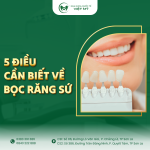 5-dieu-can-biet-ve-boc-rang-su