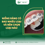 NIENG-RANG-CO-BAO-NHIEU-LOAI